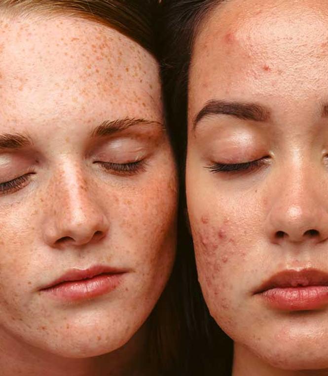Trattamenti Viso e Corpo
